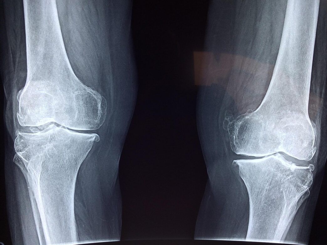 x ray