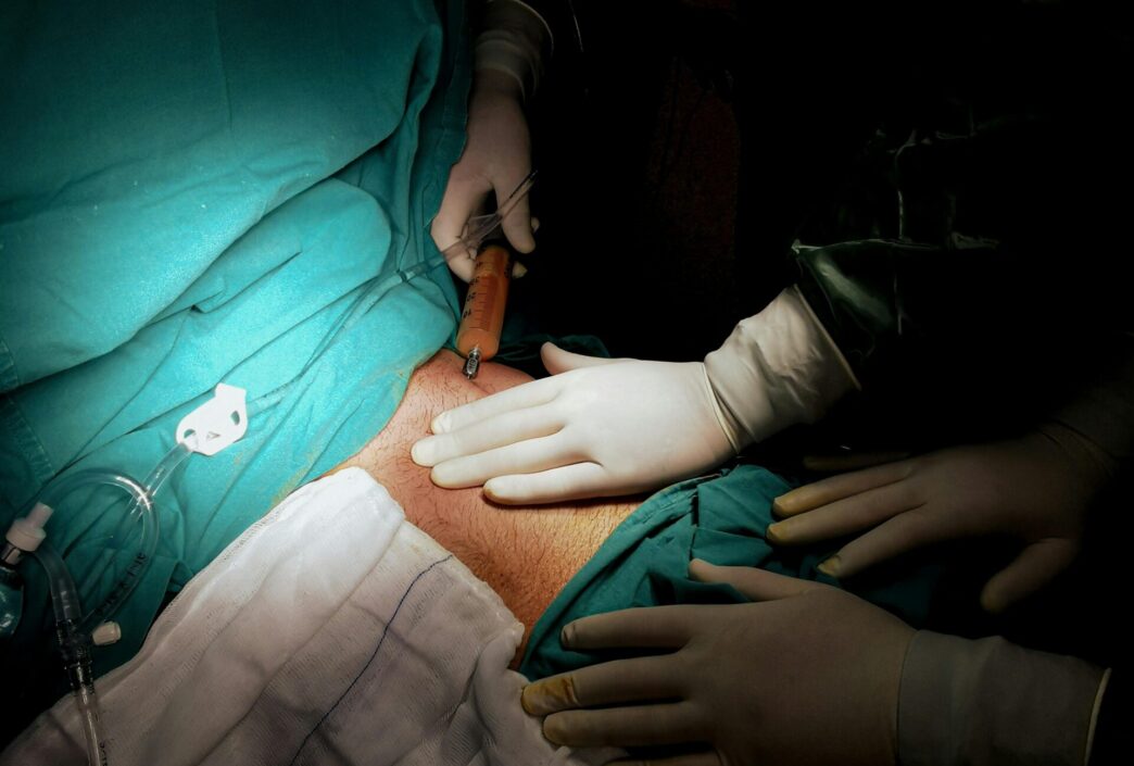 liposukcija scaled e1767691258498